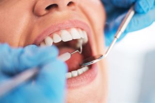 examen dentaire d'une femme