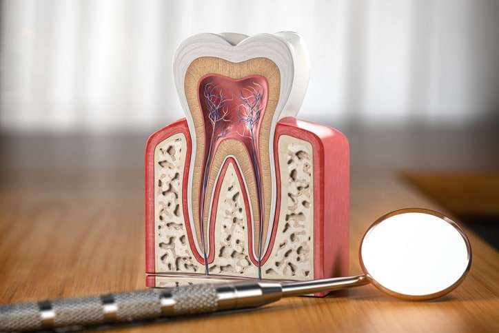 traitement endodontique